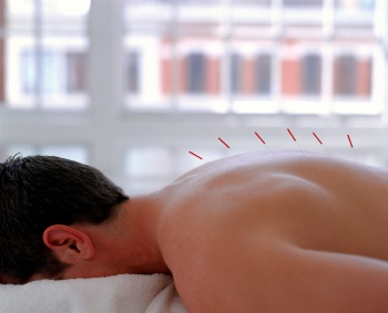 usos de la acupuntura